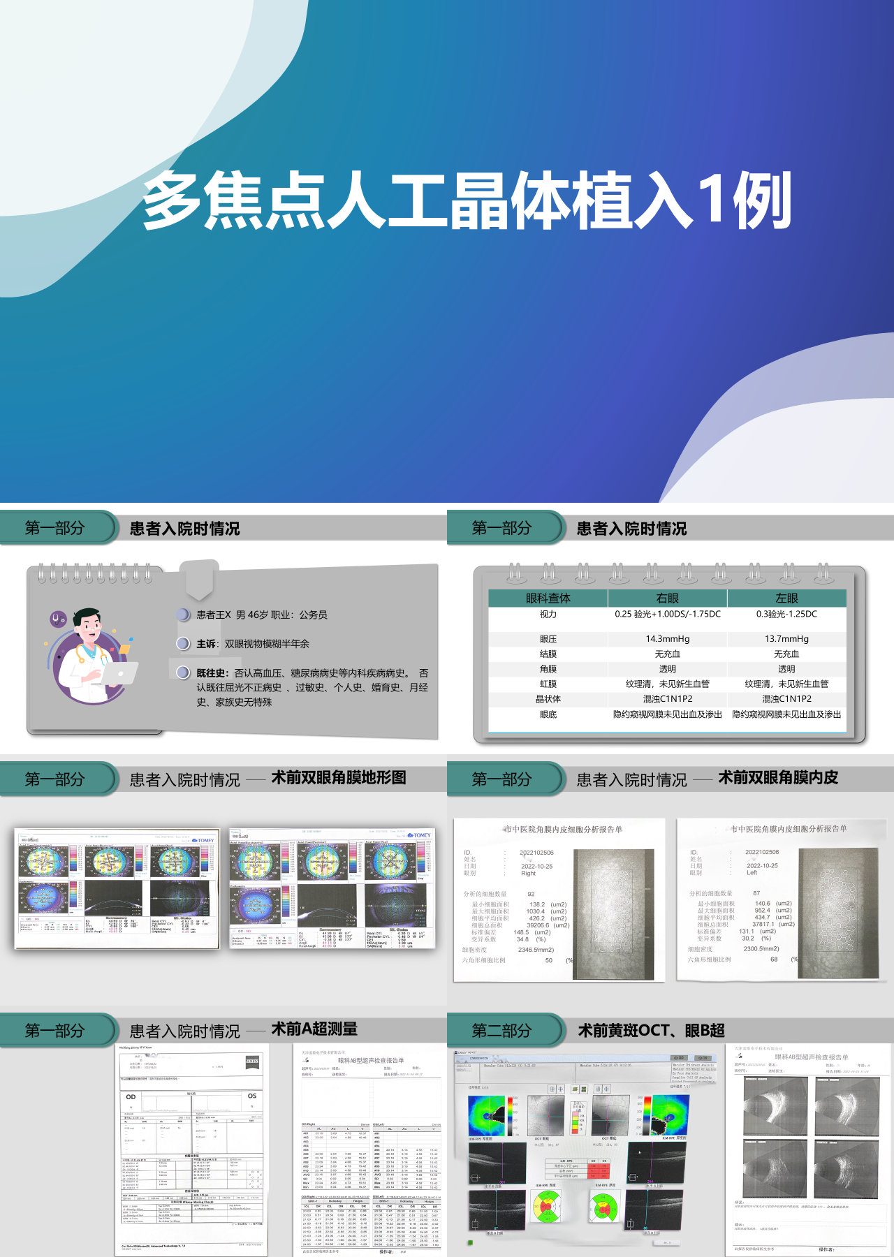 简单动态灰色医学报告多焦点人工晶体置入1例