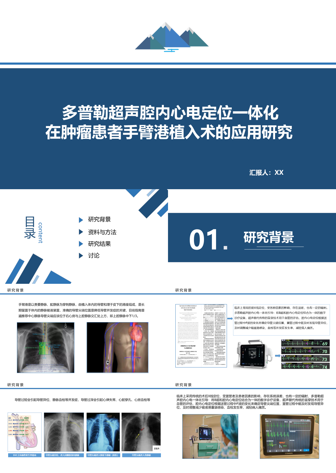 简单动态灰色医学汇报多普勒超声腔内心电定位一体化在肿瘤患者手臂港植入术的应用