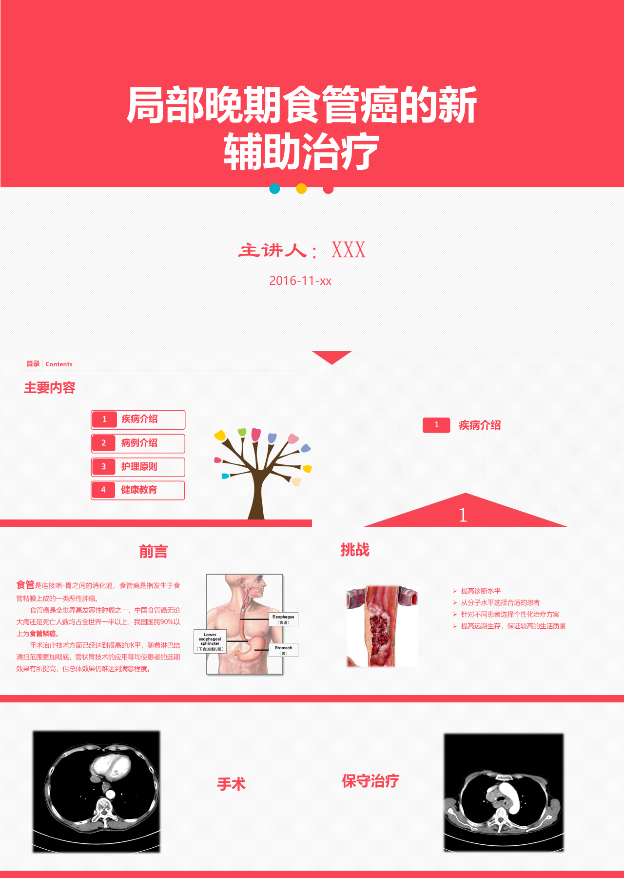 简单静态红色局部晚期食管癌新辅助治疗