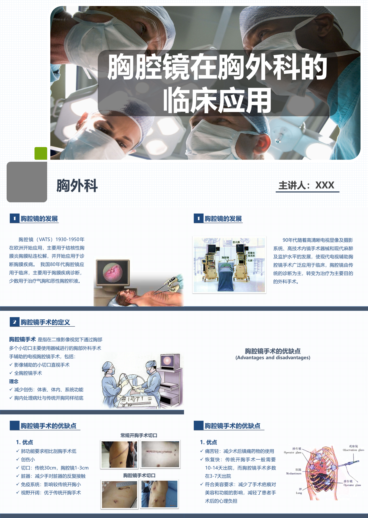 简单静态灰色胸腔镜在胸外科的临床应用
