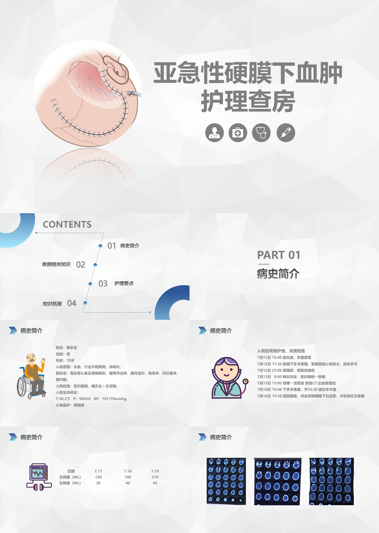 简单动态灰色亚急性硬膜下血肿护理查房