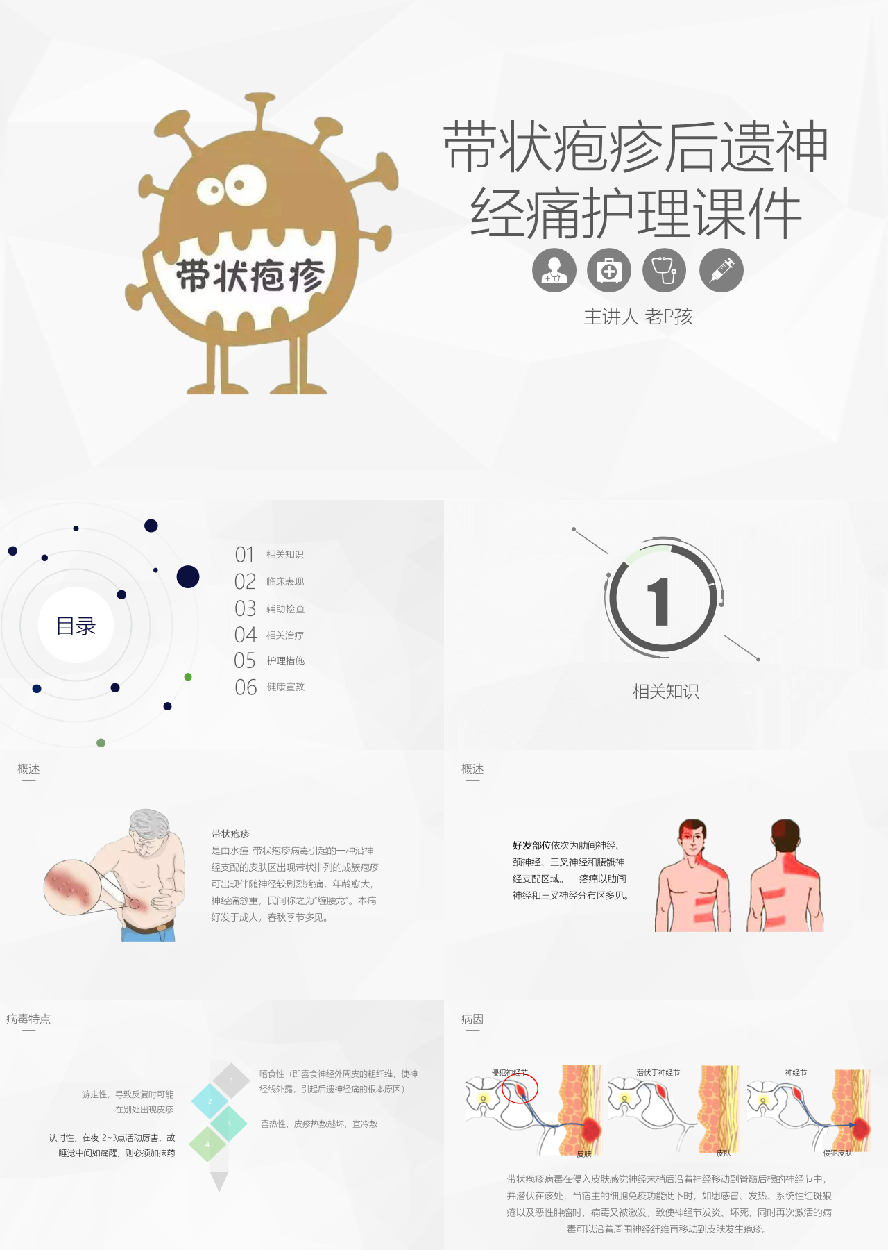 简单动态棕黄色带状疱疹后遗神经痛护理