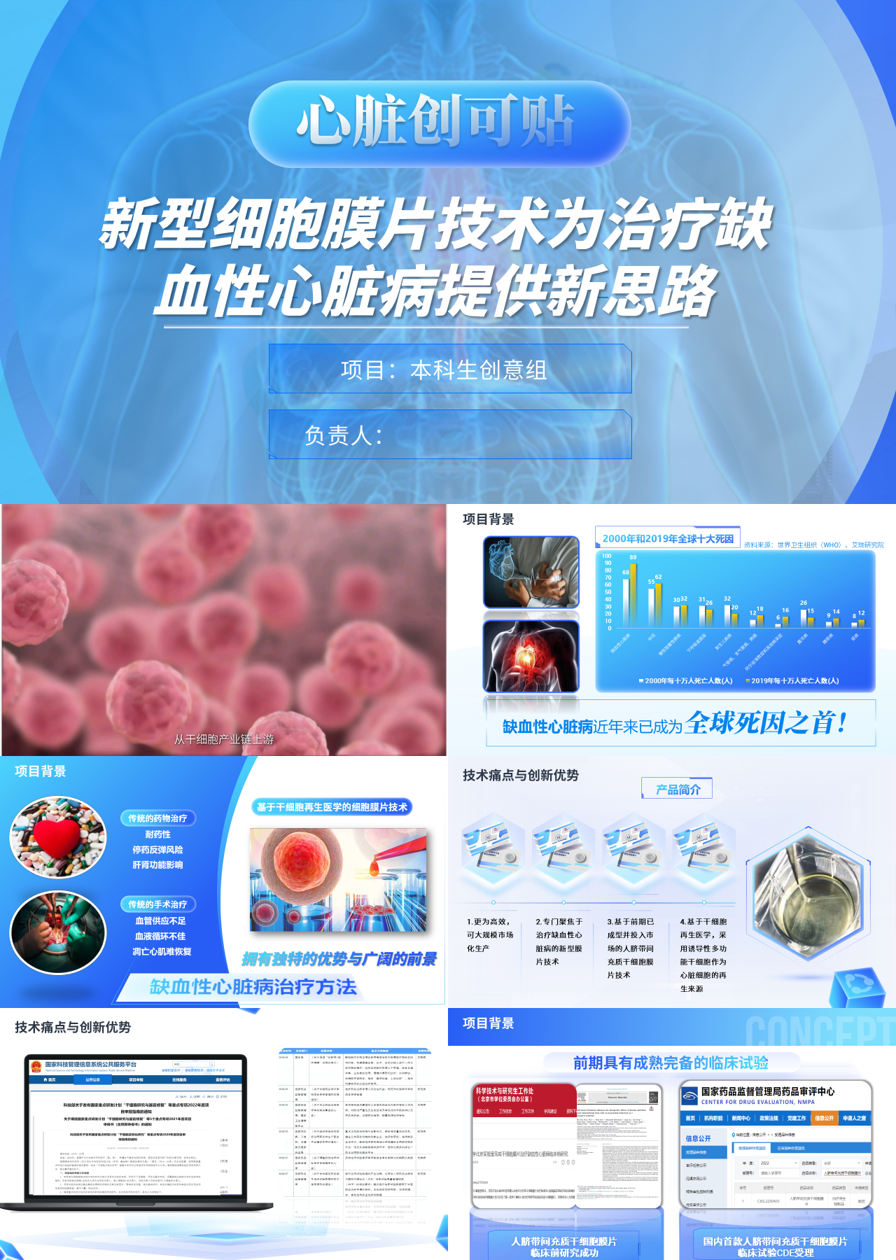 高端静态蓝色商业计划书医疗缺血性心脏病治疗新思路