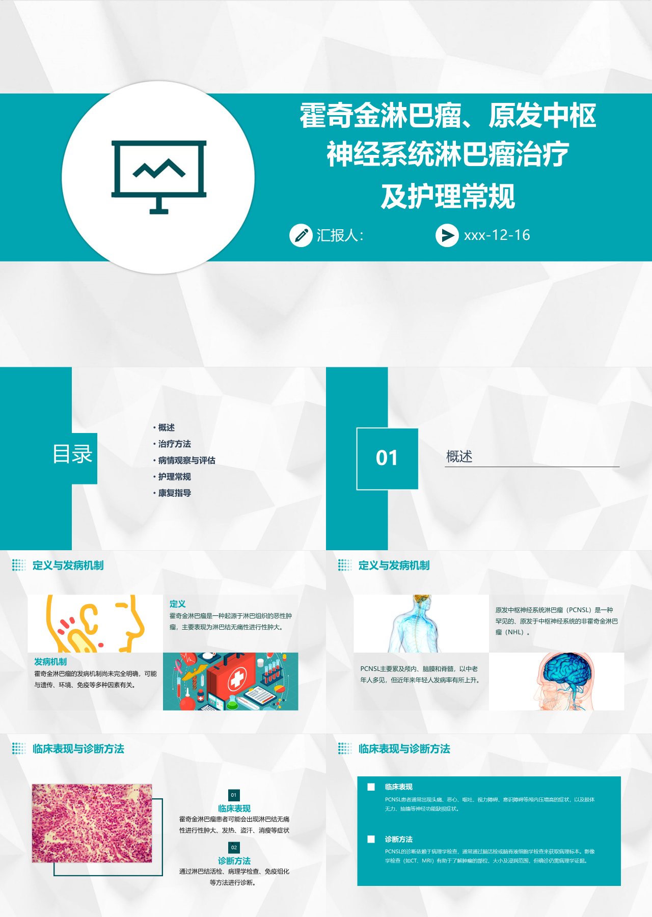 标准静态绿色工作汇报中枢神经系统淋巴瘤治疗