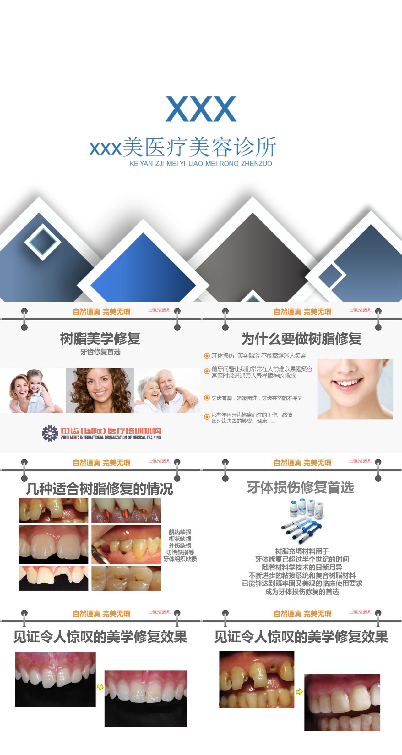 标准静态简约主题教育树脂美学修复医患沟图谱