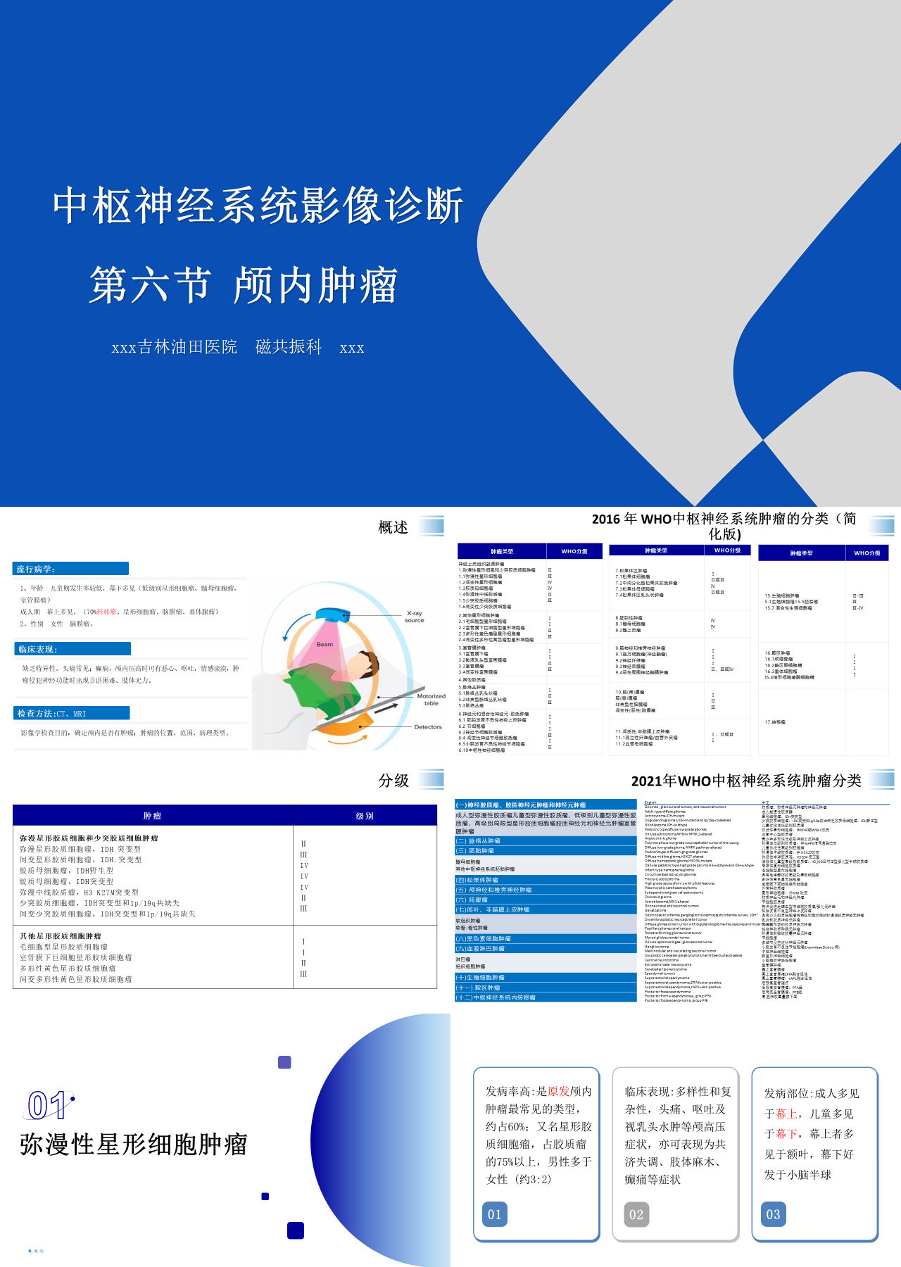 标准静态蓝色主题教育中枢神经系统影像诊断