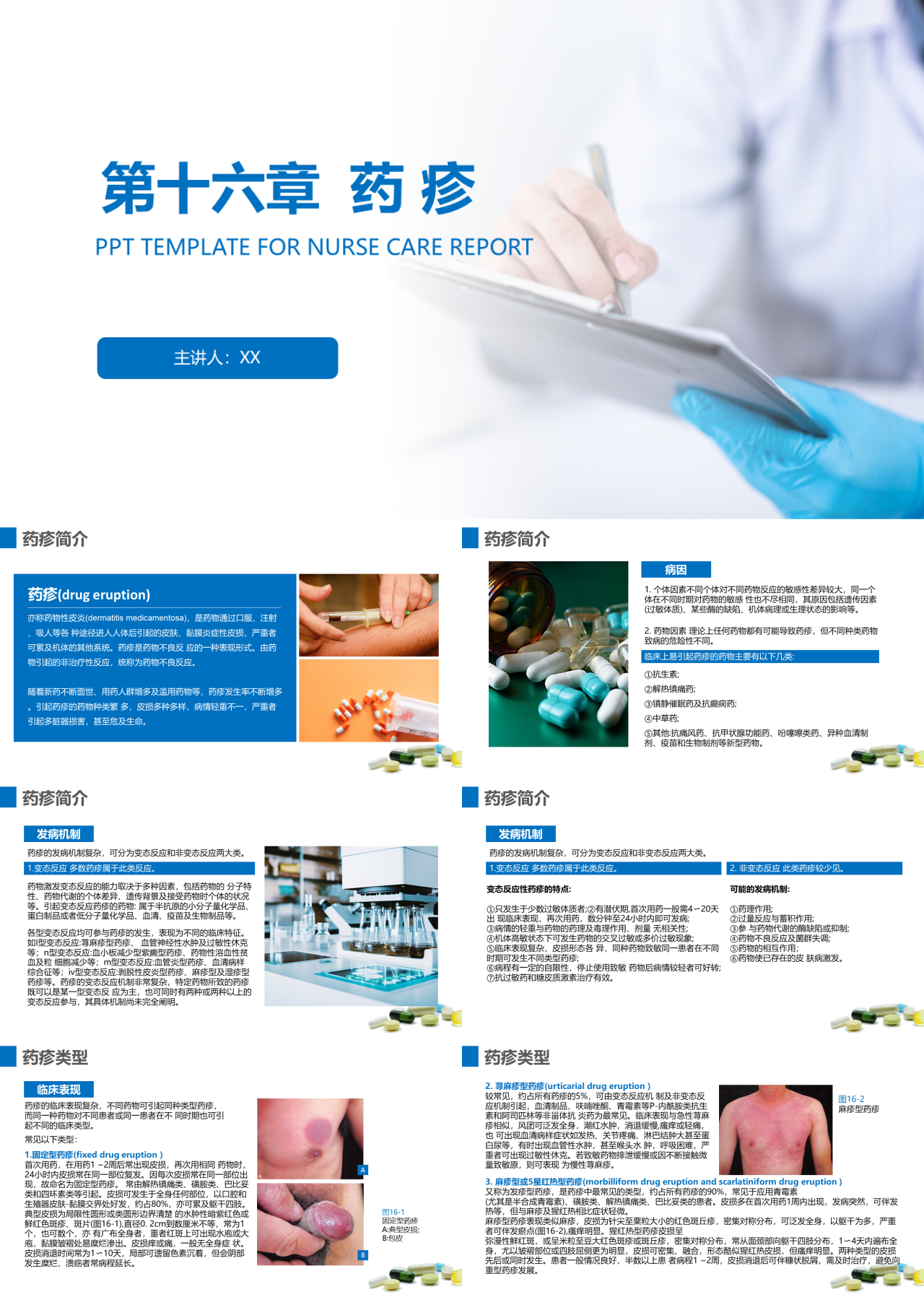 标准静态蓝色主题教育第十六章药疹