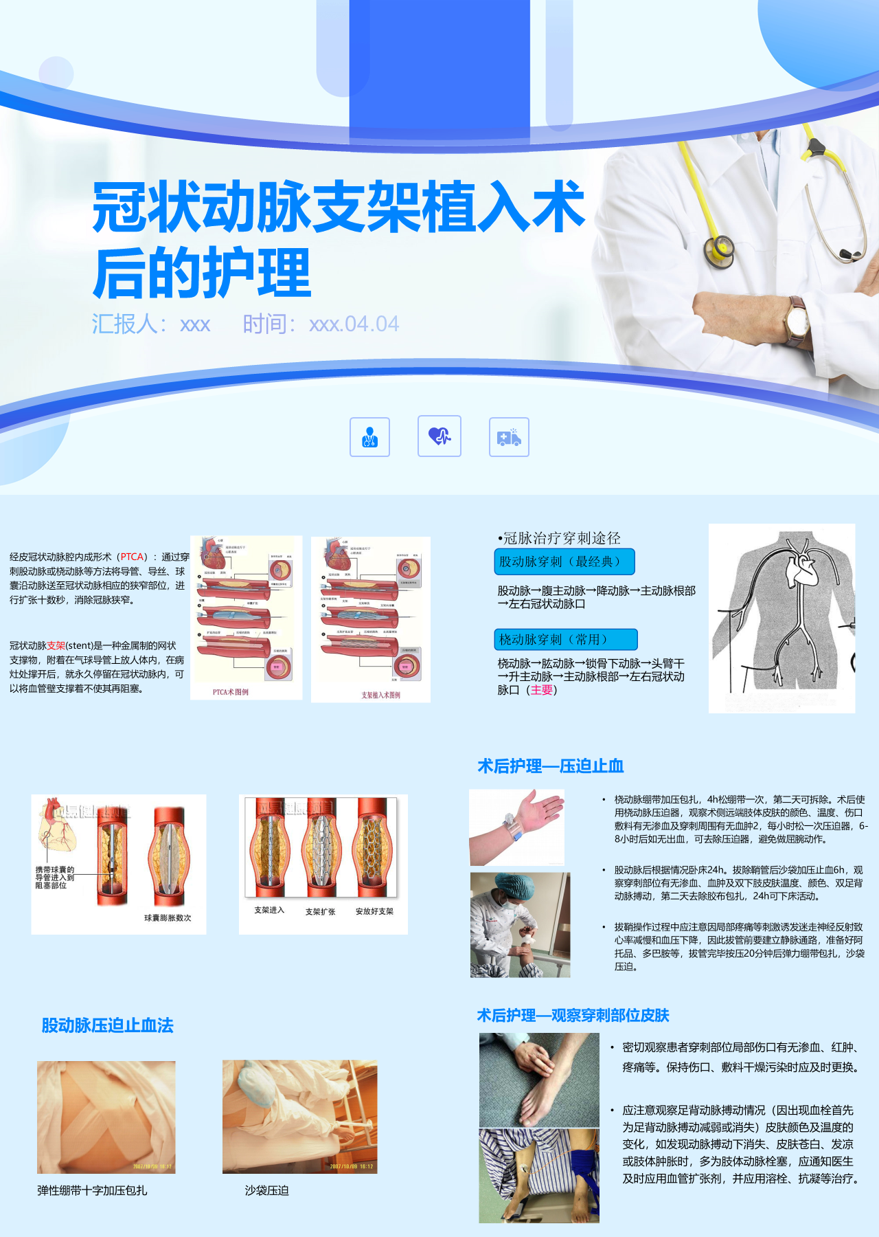 标准静态蓝色企业培训冠状动脉支架植入术后的护理