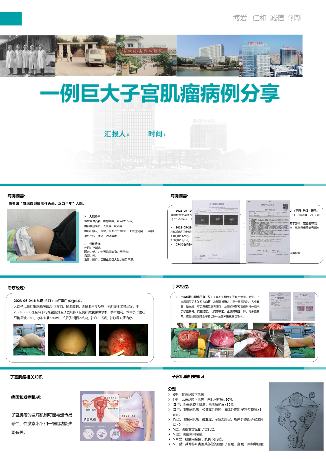 标准静态绿色工作汇报一例巨大子宫肌瘤病例分享1