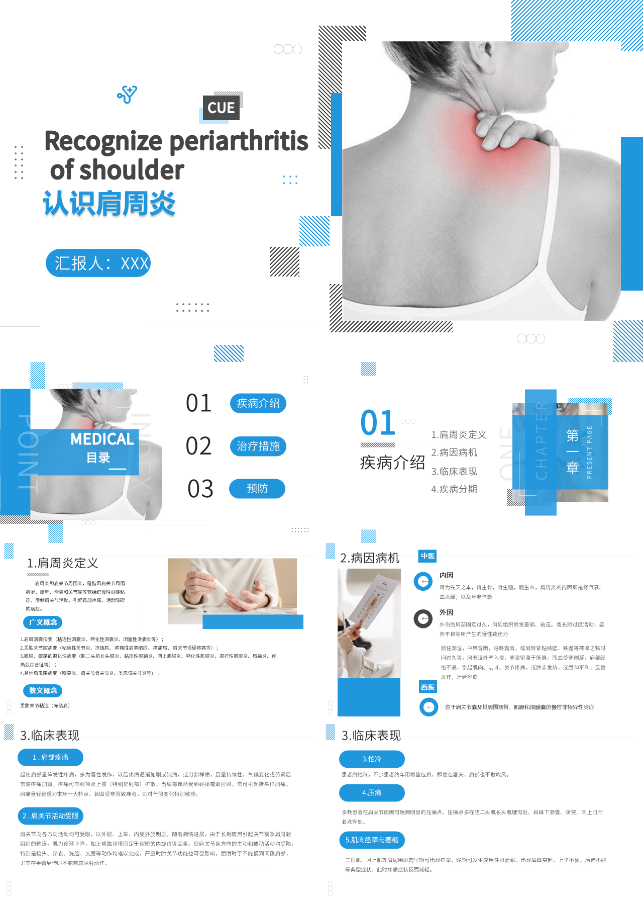 标准动态蓝色教育课件认识肩周炎