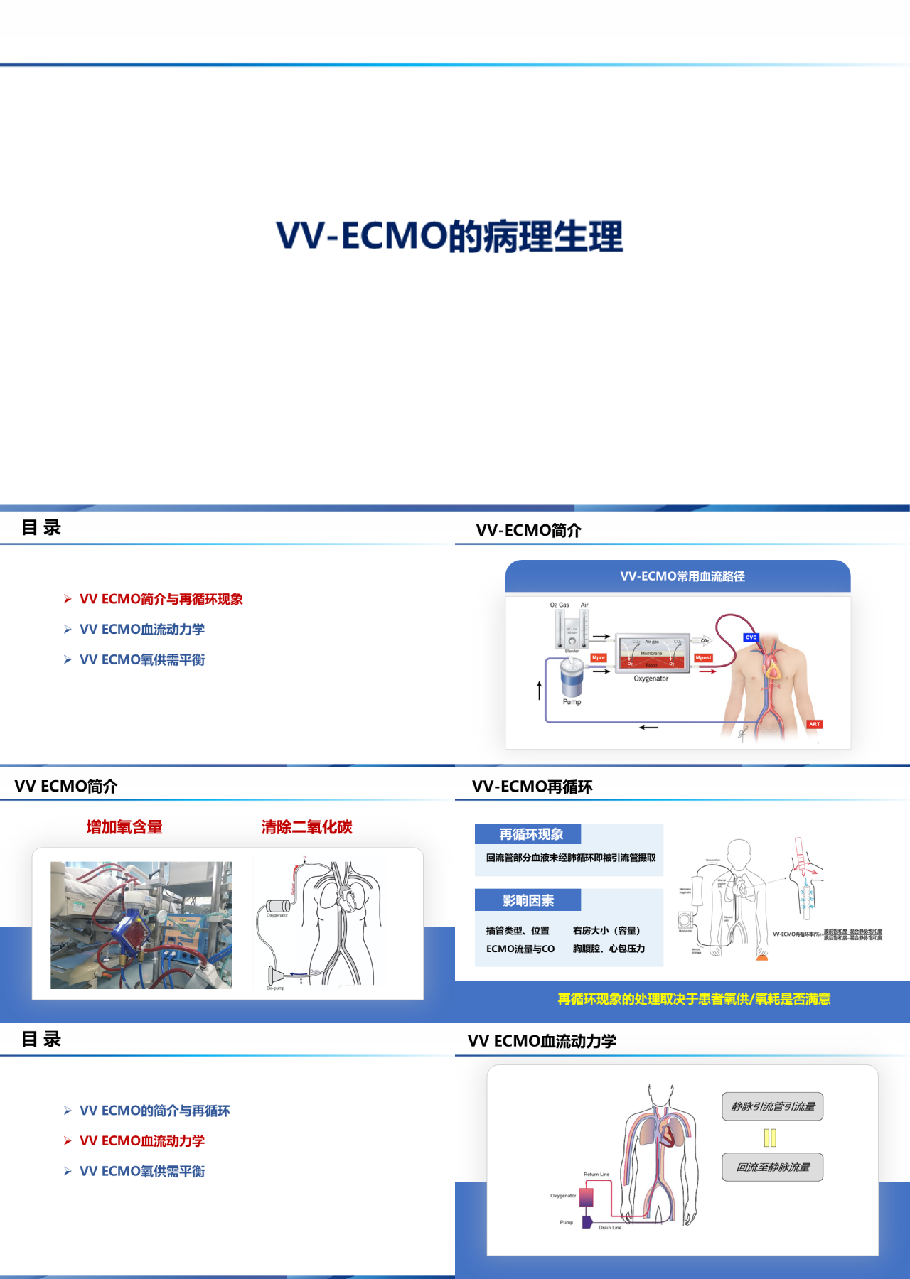 标准静态蓝色教育课件VVECMO病理生理