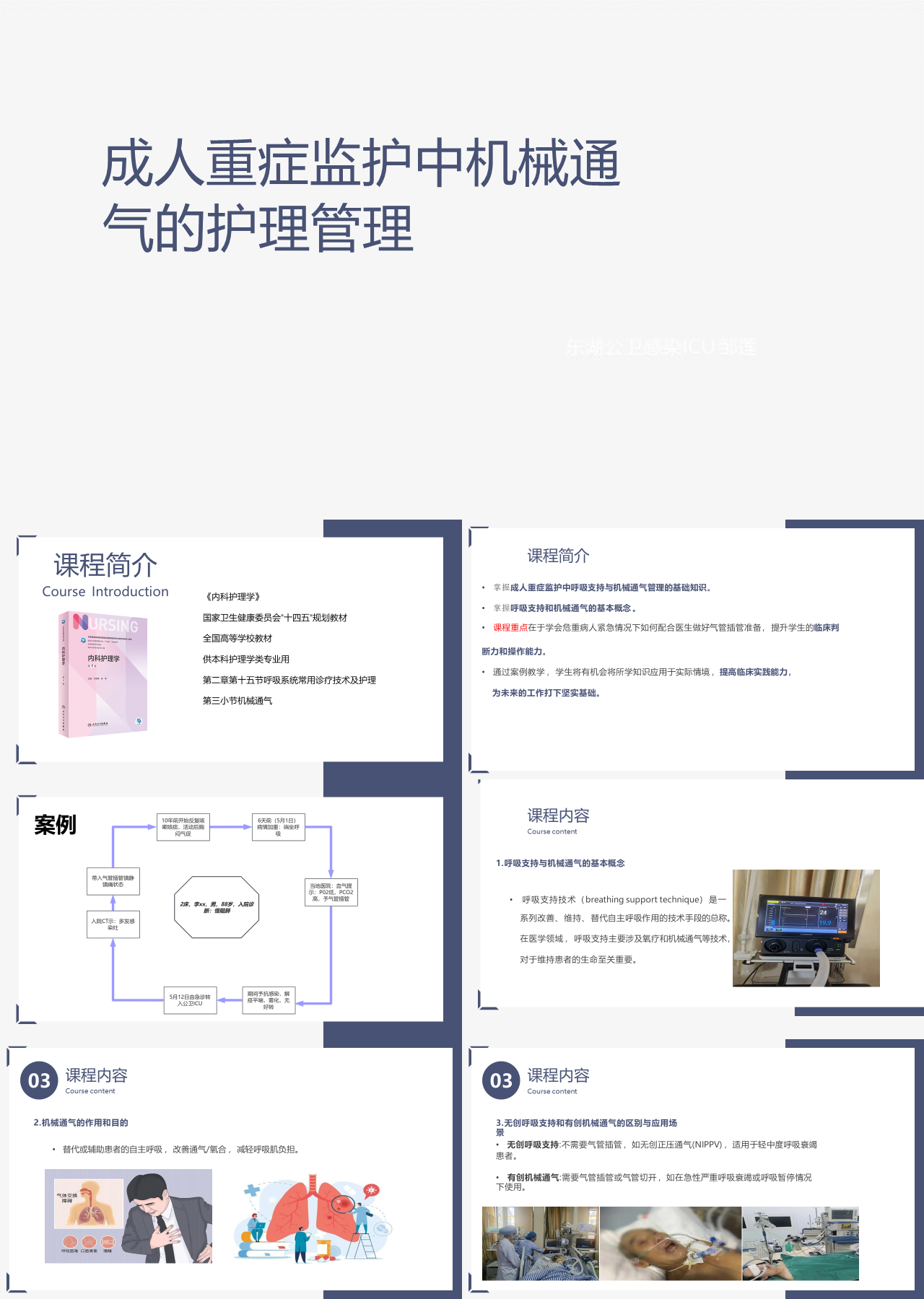 简单静态简约工作汇报成人重症监护中的呼吸支持与机械通气管理