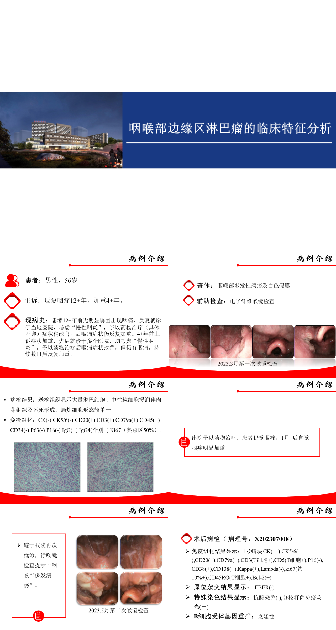 标准静态蓝色工作汇报咽喉部边缘区淋巴瘤的临床特征分析