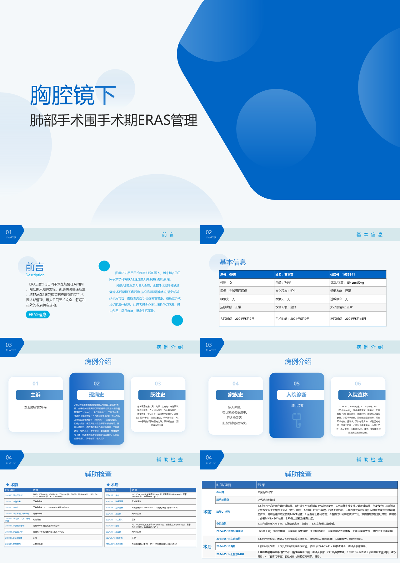 标准静态蓝色企业培训胸腔镜下肺部手术围手术期ERAS管理