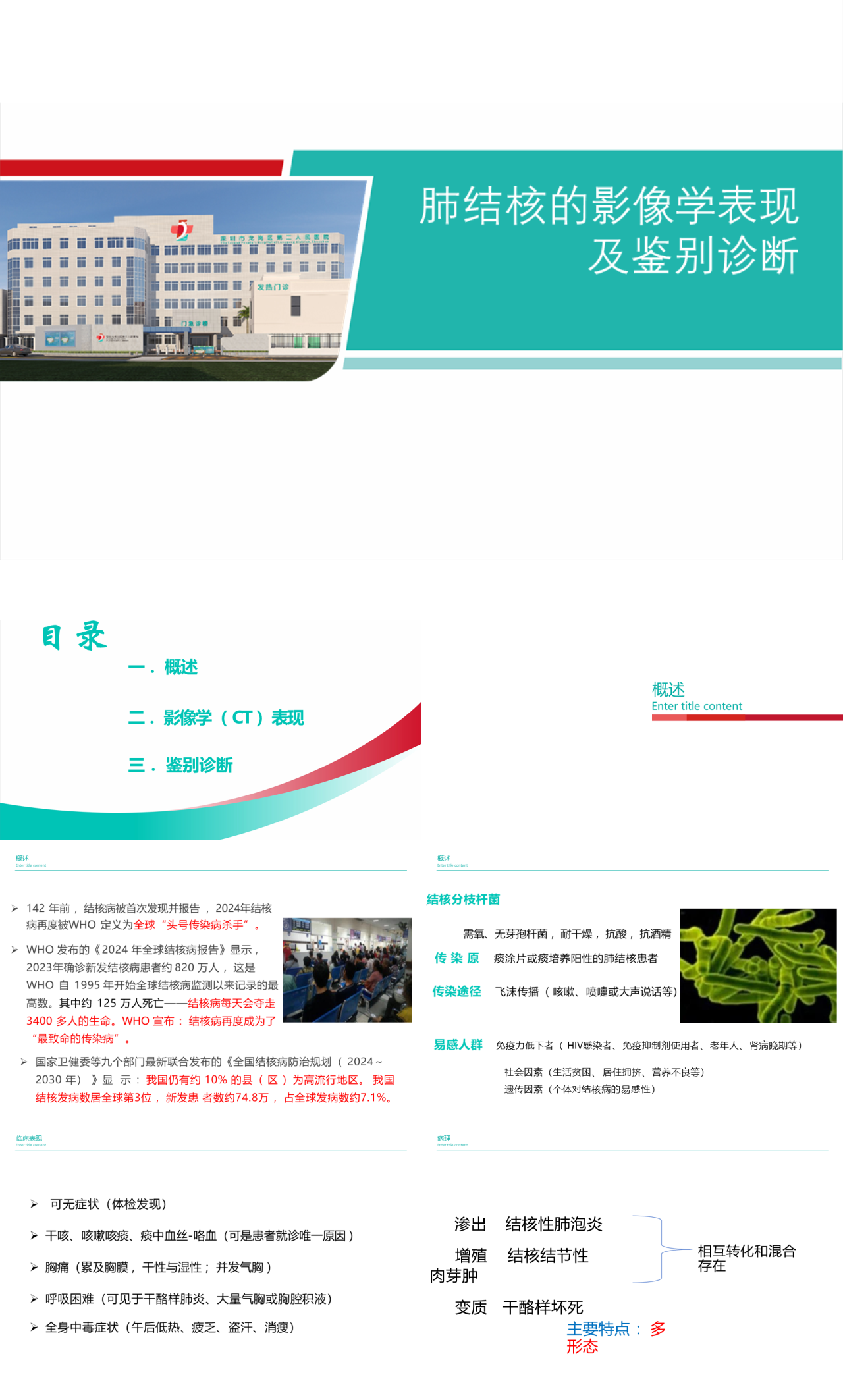 标准静态绿色工作汇报肺结核的影像学表现及鉴别诊断