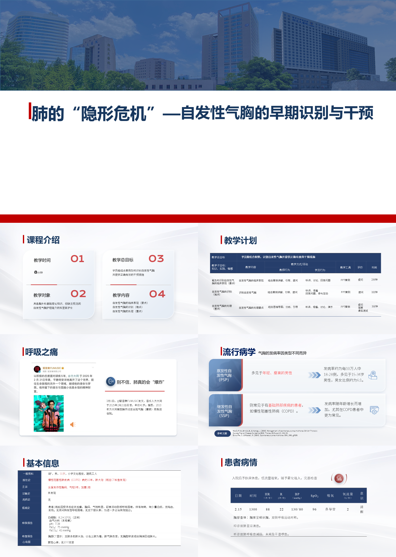 标准静态蓝色主题教育肺的自发性气胸的早期识别与干预