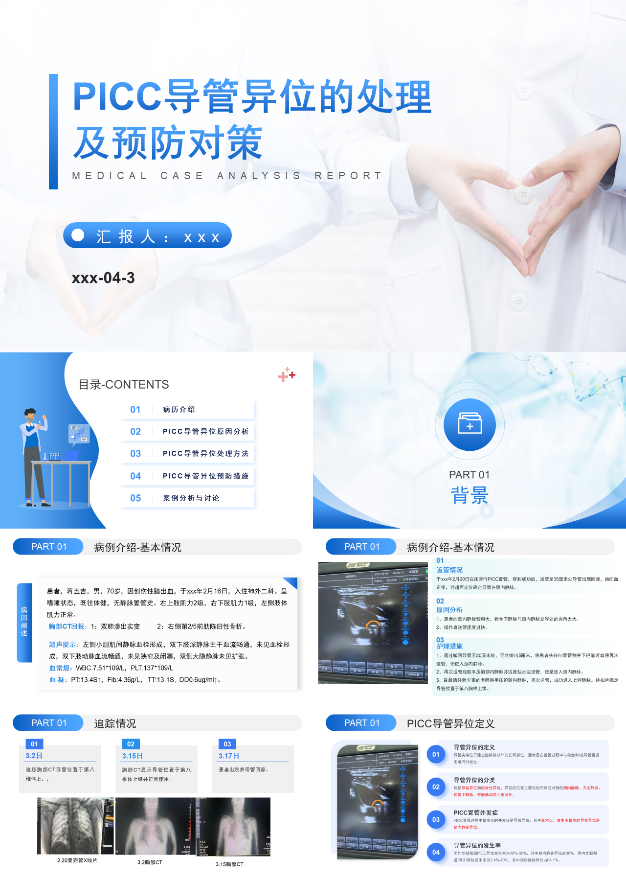 标准静态蓝色工作汇报PICC导管异位的处理及预防对策
