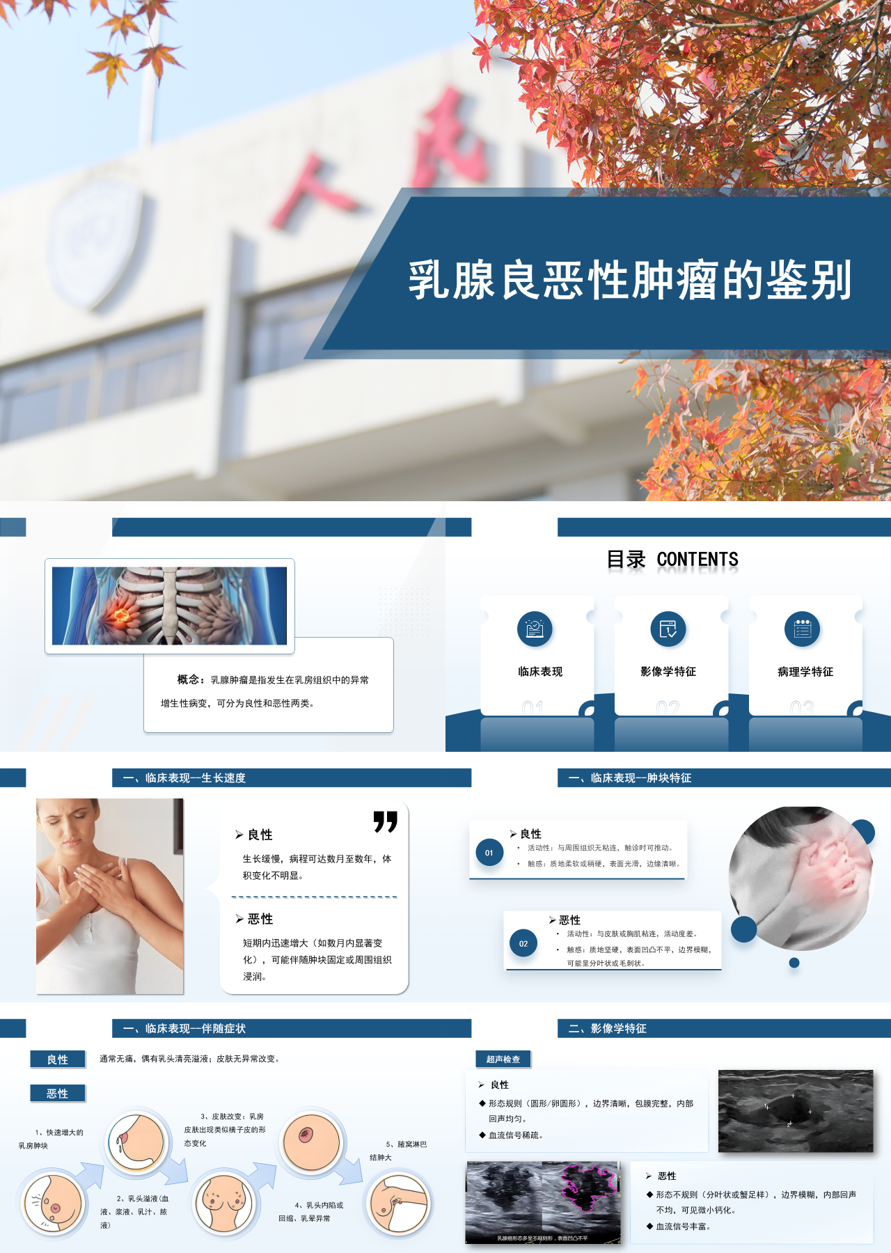 标准静态蓝色主题教育乳腺良恶性肿瘤的鉴别