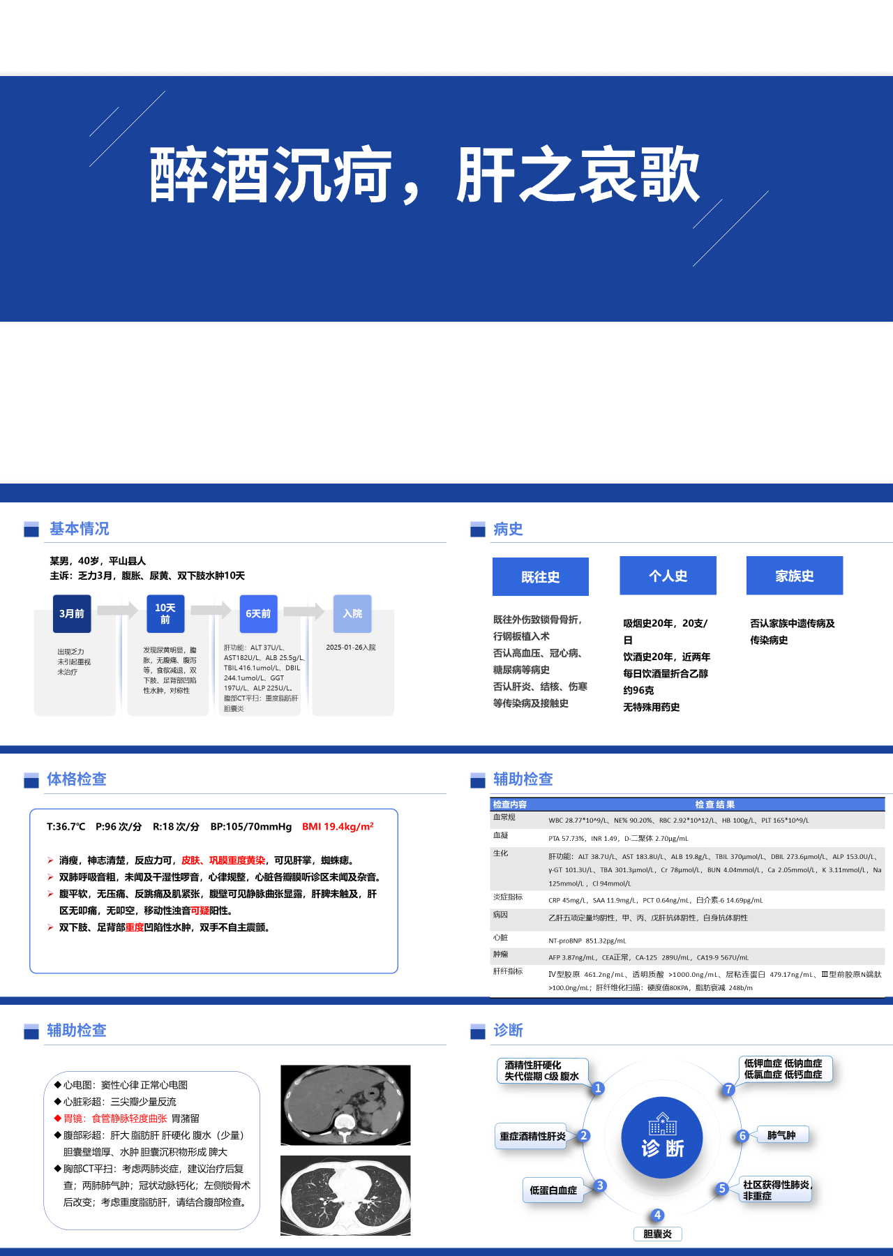 标准静态蓝色工作汇报醉酒沉疴肝之哀歌